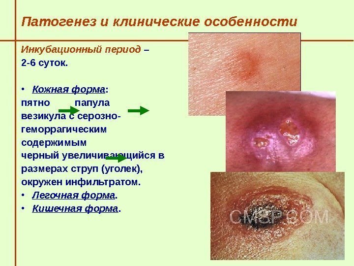   Патогенез и клинические особенности  Инкубационный период – 2 -6 суток. 