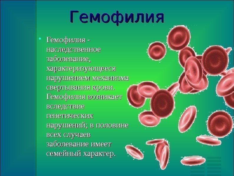 Гемофилия - наследственное заболевание,  характеризующееся нарушением механизма свертывания крови.  Гемофилия возникает вследствие