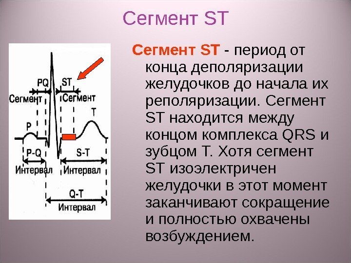 Сегмент ST - период от конца деполяризации желудочков до начала их реполяризации. Сегмент ST