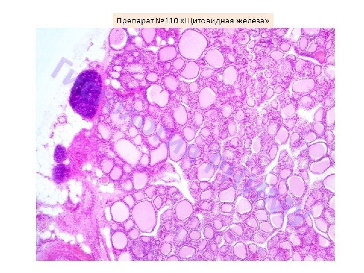 Щитовидная железа гистология рисунок