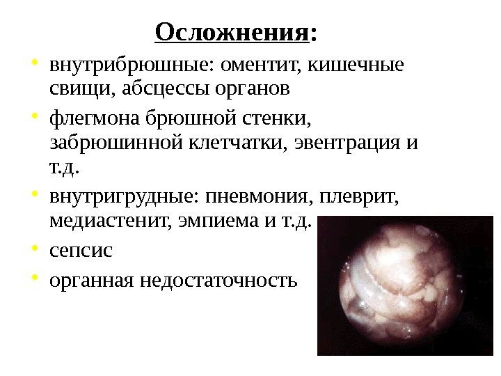 Осложнения :  • внутрибрюшные: оментит, кишечные свищи, абсцессы органов • флегмона брюшной стенки,