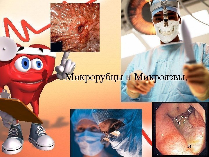       Микрорубцы и Микроязвы. 14 