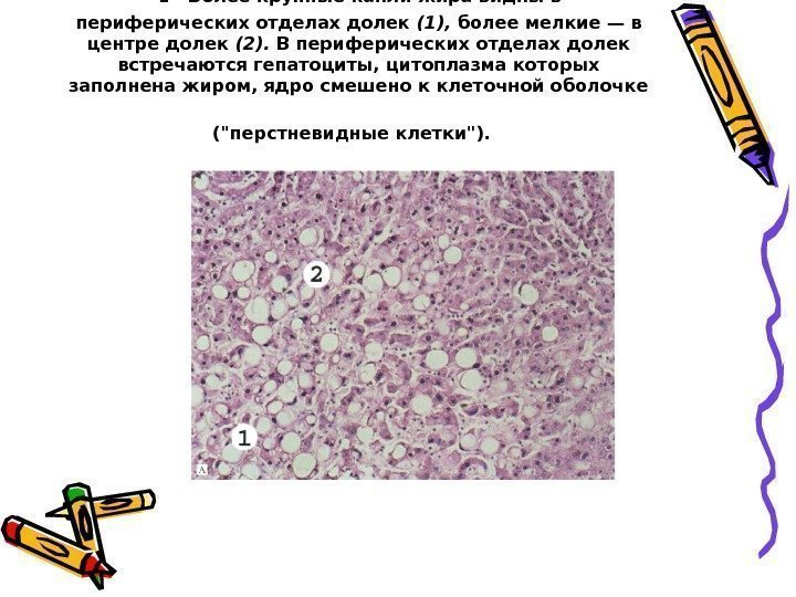  .  Более крупные капли жира видны в периферических отделах долек (1), 