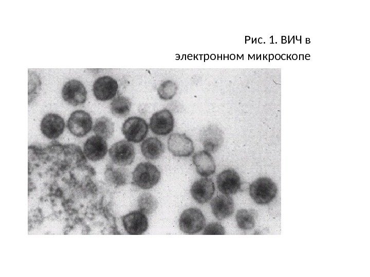  Рис. 1. ВИЧ в электронном микроскопе 