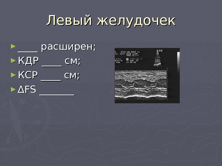 Кдр левого желудочка. КДР левого желудочка норма. КСР левого желудочка норма. Конечный систолический размер левого желудочка норма. КДР норма ЭХОКГ.