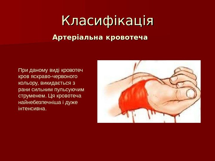Класифікація  Артеріальна кровотеча При даному виді кровотеч кров яскраво-червоного кольору, викидається з рани