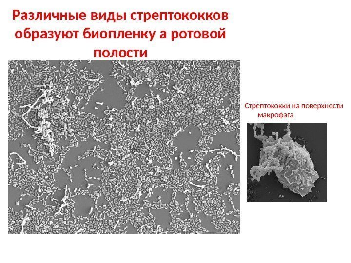 Различные виды стрептококков образуют биопленку а ротовой полости Стрептококки на поверхности макрофага 