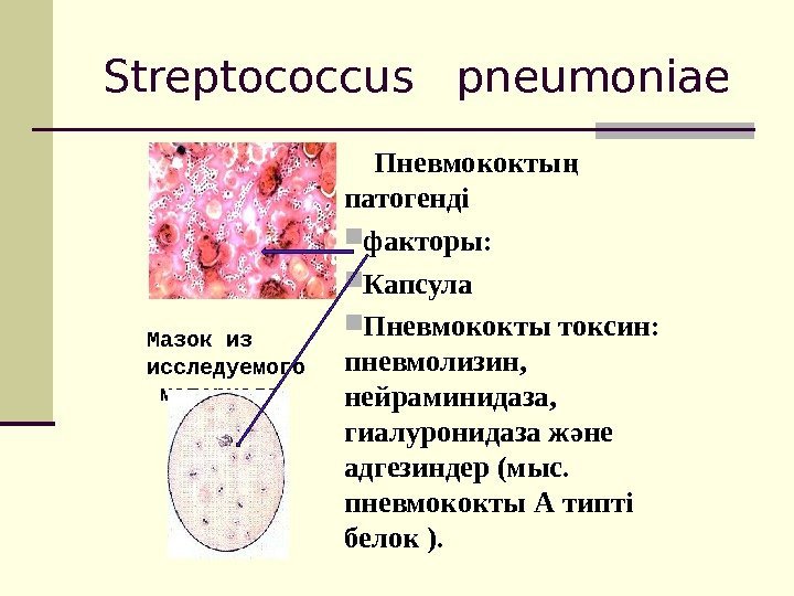 Streptococcus pneumoniae Пневмококты   ң патогенді факторы:  Капсула Пневмококты токсин:  пневмолизин,