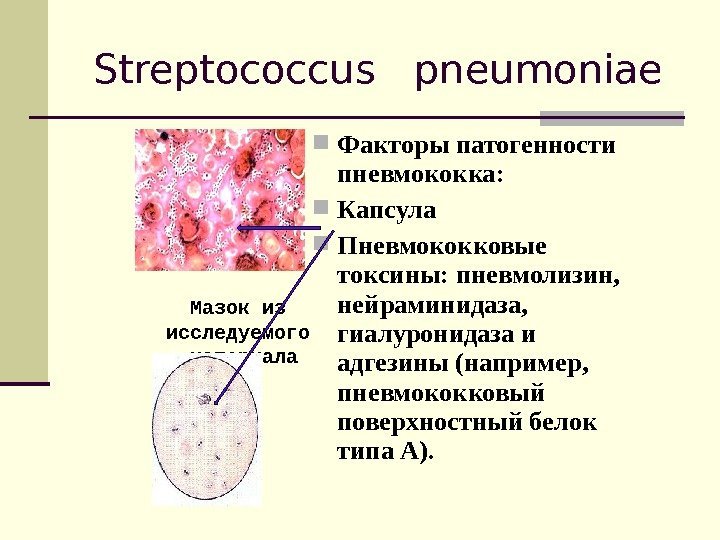 Streptococcus pneumoniae Факторы патогенности пневмококка:  Капсула Пневмококковые токсины: пневмолизин,  нейраминидаза,  гиалуронидаза