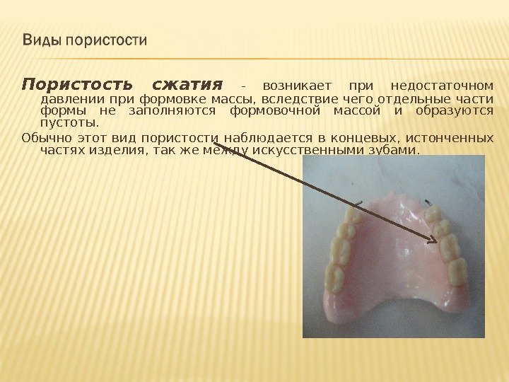 Пластмассы в стоматологии презентация