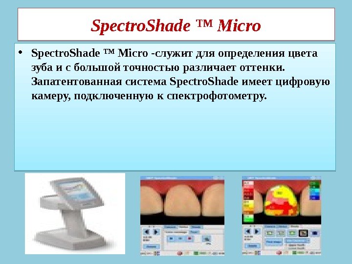 Spectro. Shade ™ Micro • Spectro. Shade ™ Micro -служит для определения цвета зуба