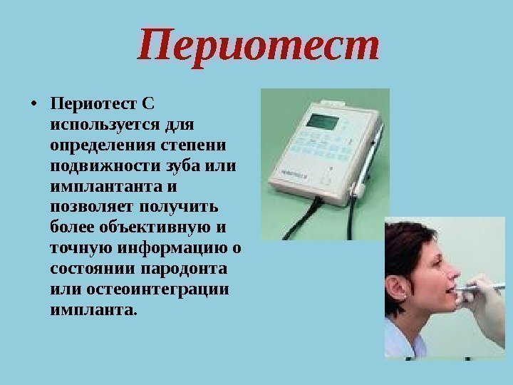  • Периотест С используется для определения степени подвижности зуба или имплантанта и позволяет