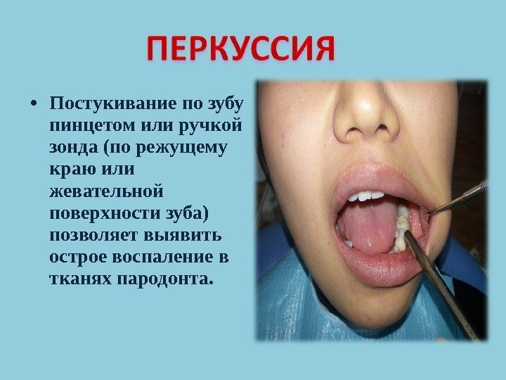  • Постукивание по зубу пинцетом или ручкой зонда (по режущему краю или жевательной