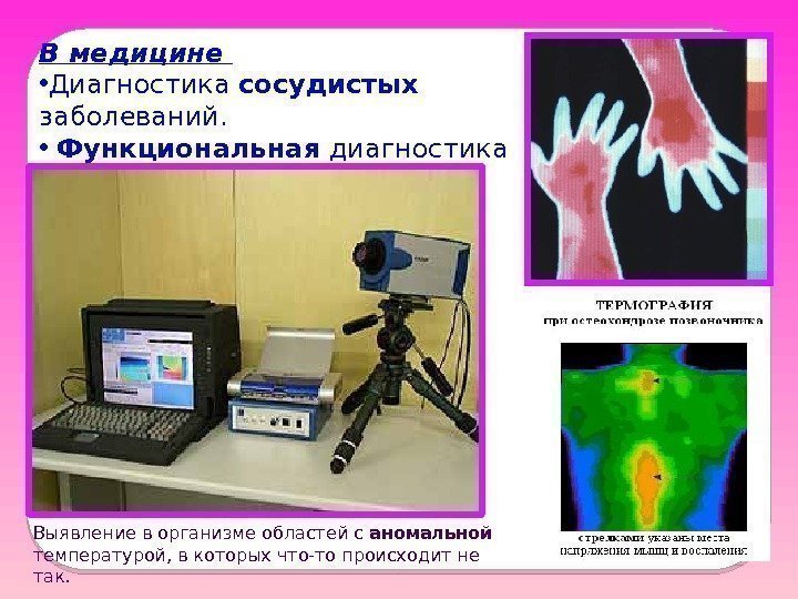 В медицине  • Диагностика сосудистых заболеваний.  •  Функциональная диагностика Выявление в