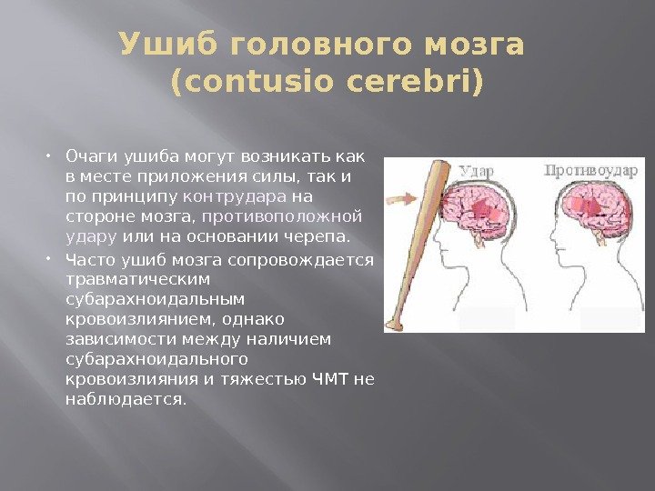 Ушиб головного мозга (contusio cerebri) Очаги ушиба могут возникать как в месте приложения силы,