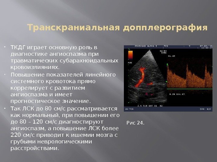 Транскраниальная допплерография ТКДГ играет основную роль в диагностике ангиоспазма при травматических субарахноидальных кровоизлияниях. 