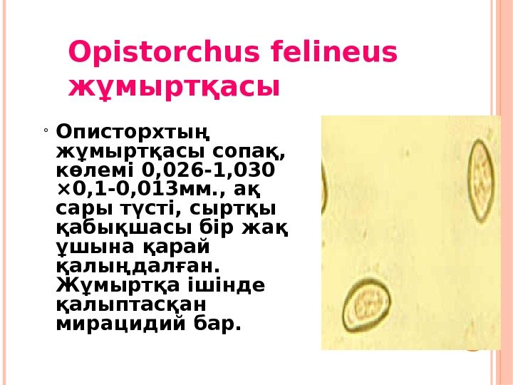 Opistorchus felineus жұмыртқасы Описторхтың жұмыртқасы сопақ,  көлемі 0, 026 -1, 030 × 0,