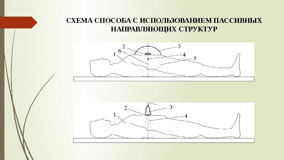 СХЕМА СПОСОБА С ИСПОЛЬЗОВАНИЕМ ПАССИВНЫХ НАПРАВЛЯЮЩИХ СТРУКТУР   