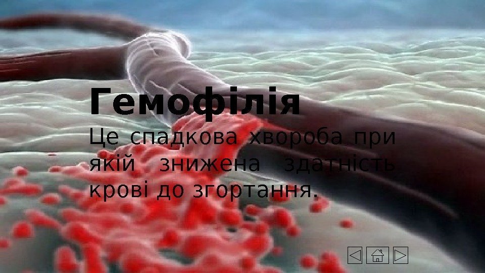 Гемофілія  Це спадкова хвороба при якій знижена здатність крові до згортання. 