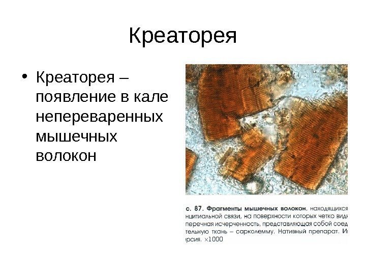 Креаторея • Креаторея – появление в кале непереваренных мышечных волокон 