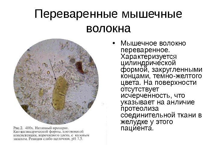 Переваренные мышечные волокна • Мышечное волокно переваренное.  Характеризуется цилиндрической формой, закругленными концами, темно-желтого