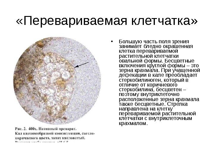  «Перевариваемая клетчатка»  • Большую часть поля зрения занимает бледно окрашенная клетка перевариваемой