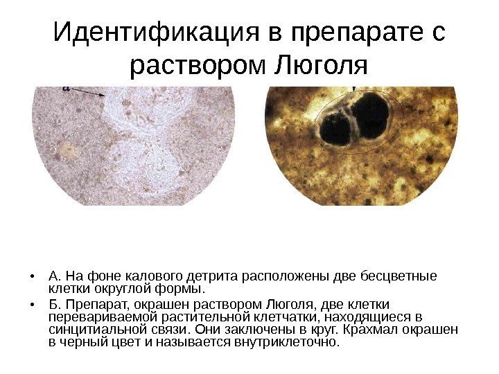 Идентификация в препарате с раствором Люголя • А. На фоне калового детрита расположены две