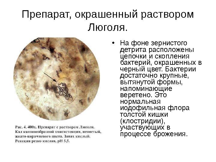 Препарат, окрашенный раствором Люголя.  • На фоне зернистого детрита расположены цепочки и скопления