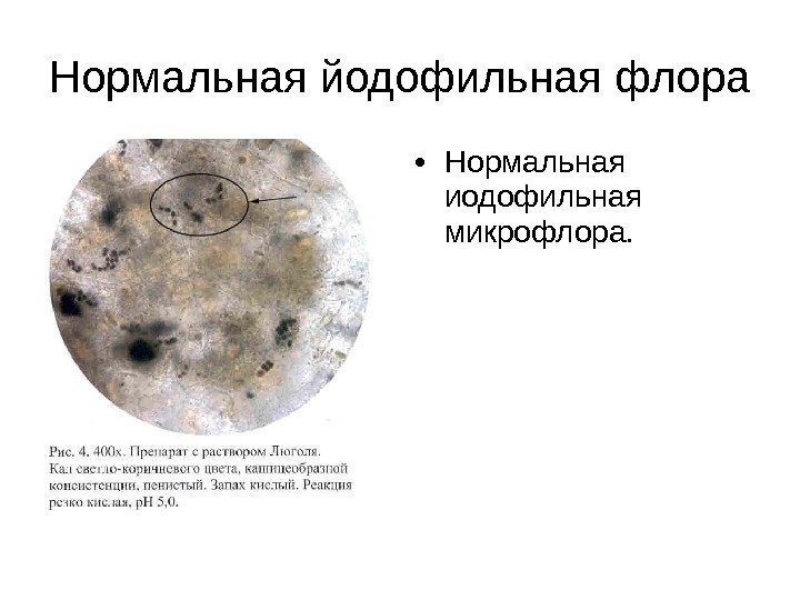 Нормальная йодофильная флора • Нормальная иодофильная микрофлора. 