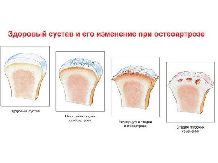 Опорно двигательная система рисунок с подписями