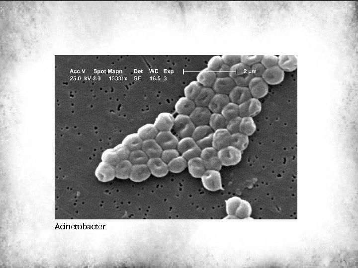  Acinetobacter 