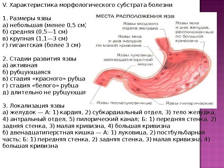 V. Характеристика морфологического субстрата болезни 1. Размеры язвы а) небольшая (менее 0, 5 см)