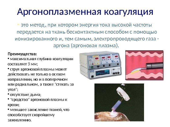 Аргоноплазменная коагуляция  - это метод, при котором энергия тока высокой частоты передается на