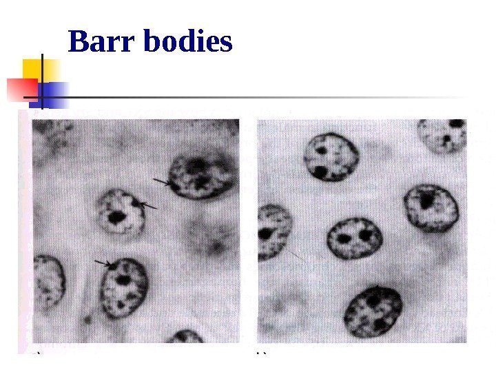   Barr bodies 