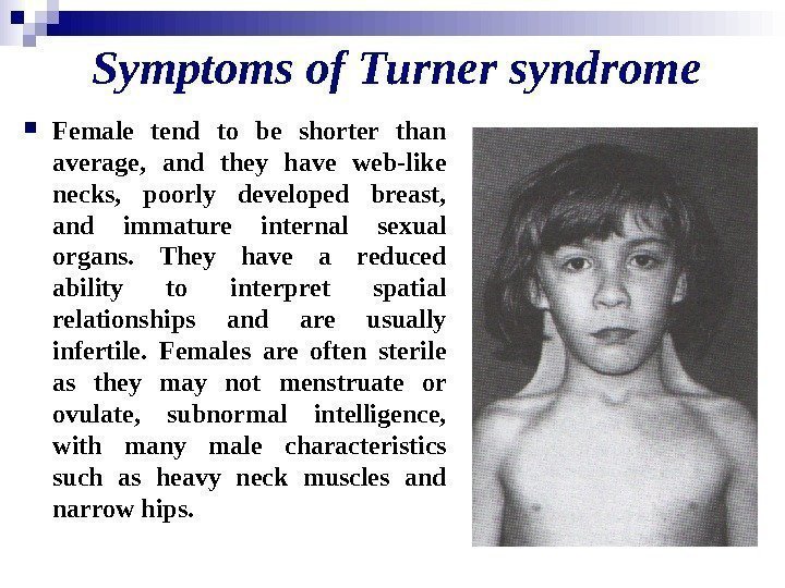   Symptoms of Turner syndrome Female tend to be shorter than average, 