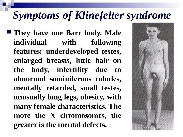   Symptoms of Klinefelter syndrome They have one Barr body.  Male individual