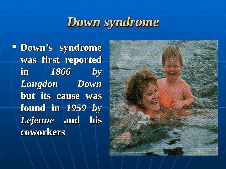  Down syndrome Down’s syndrome was first reported in in 1866 by Langdon Down