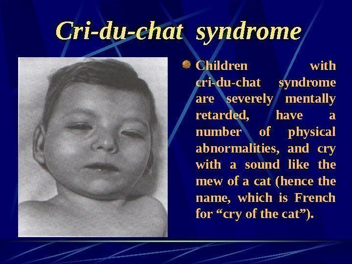   Cri-du-chat syndrome Children with cri-du-chat syndrome are severely mentally retarded,  have