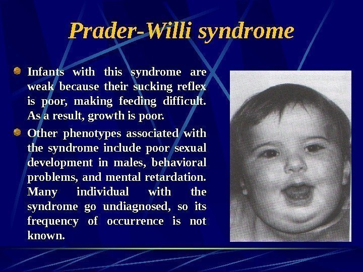  Prader-Willi syndrome Infants with this syndrome are weak because their sucking reflex