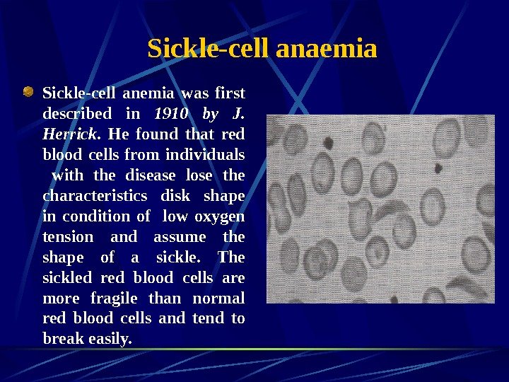   Sickle-cell anaemia Sickle-cell anemia was first described in 1910 by J. 