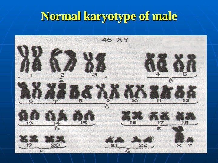  Normal karyotype of male 