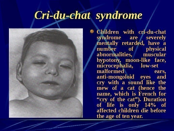   Cri-du-chat syndrome Children with cri-du-chat syndrome are severely mentally retarded,  have