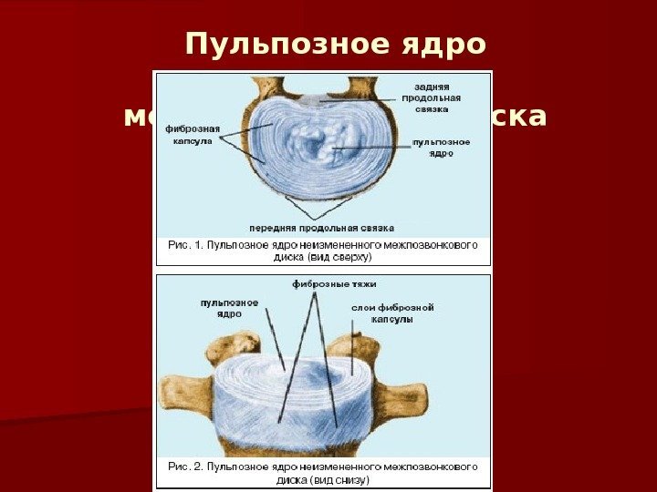 Пульпозное ядро неизмененного межпозвонкового диска 