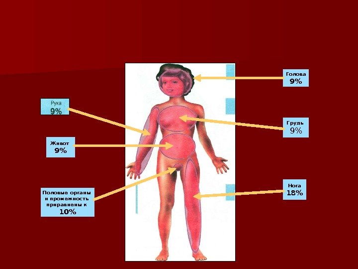 Живот 9 Половые органы и промежность приравнены к 10 Грудь  9Голова 9 Нога