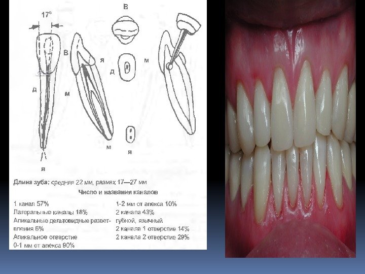 Как называются корни зубов. Длина зуба. Толщина корня зуба.