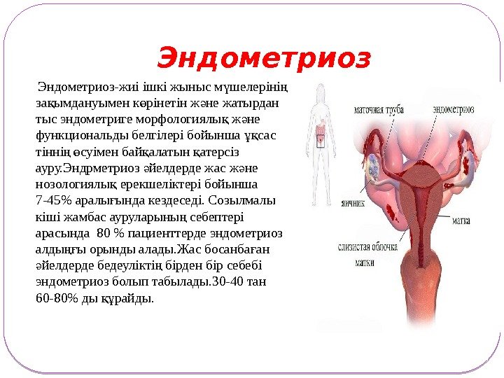 Эндометриоз-жиі ішкі жыныс м шелеріні ү ң за ымдануымен к рінетін ж не жатырдан