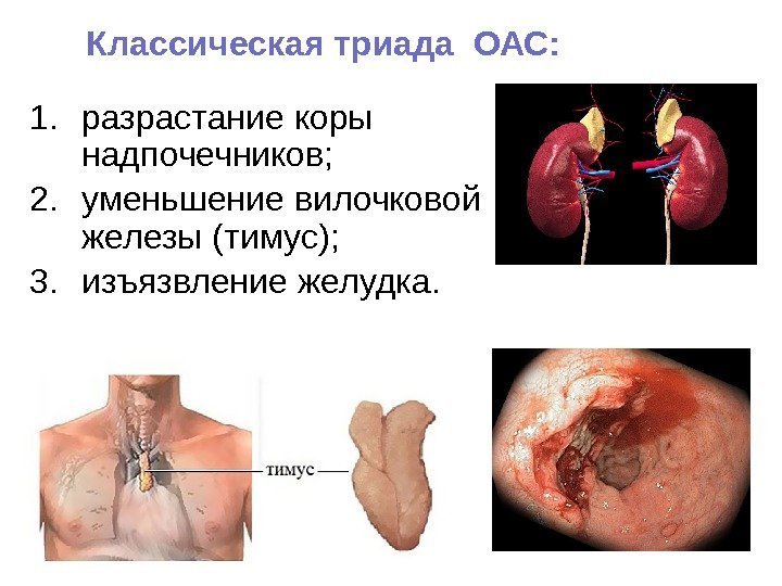 1. разрастание коры надпочечников; 2. уменьшение вилочковой железы (тимус); 3. изъязвление желудка. Классическая триада