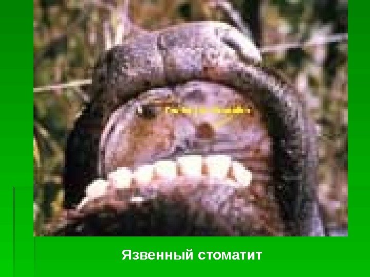   Язвенный стоматит  