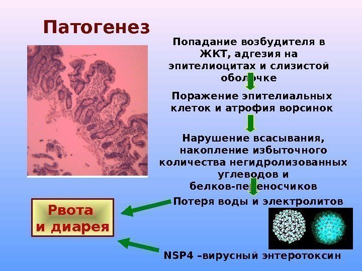 Патогенез Попадание возбудителя в ЖКТ, адгезия на эпителиоцитах и слизистой оболочке Поражение эпителиальных клеток