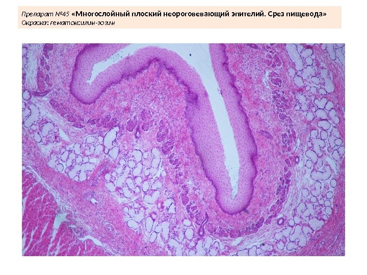 Препарат № 45  « Многослойный плоский неороговевающий эпителий. Срез пищевода» Окраска: гематоксилин-эозин 